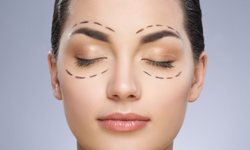 Blefaroplastika -  neaclinic.cz