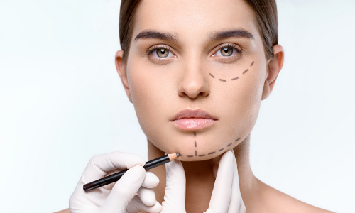 Platysmaplastika -  neaclinic.cz